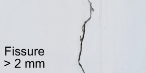 Fissure > 0 mm